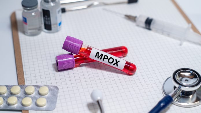 Συναγερμός για τον mpox στην Κίνα" --> "Κίνα: Συναγερμός για τον mpox - TechFreak.GR